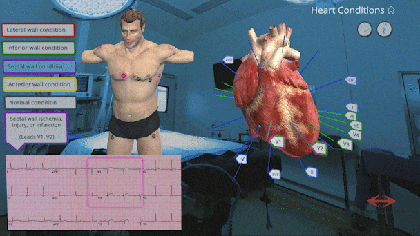 VirtualECG
